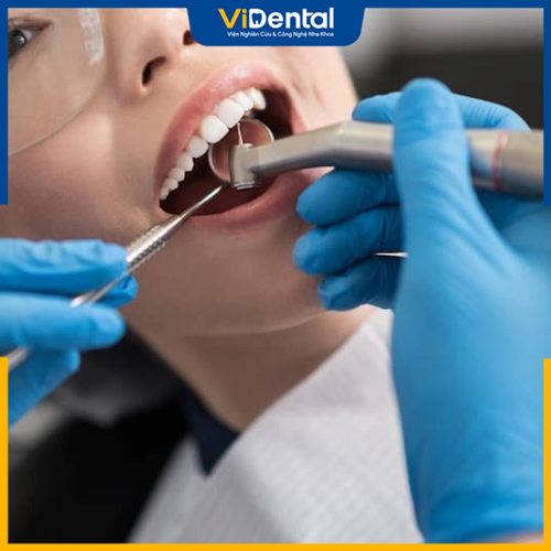 Hãy khám răng định kỳ và điều trị bệnh lý kịp thời 
