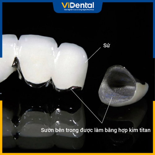 Trồng răng sứ Titan là phương pháp phục hình nha khoa phổ biến
