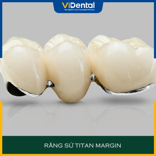 Răng sứ Titan Margin sở hữu màu sắc tự nhiên