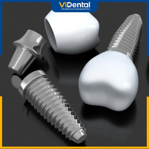 Trụ có cấu tạo đặc biệt giúp tăng hiệu quả trong việc cấy ghép răng