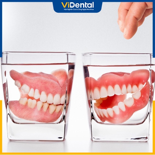 Độ bền của răng giả implant cao hơn răng giả tháo lắp