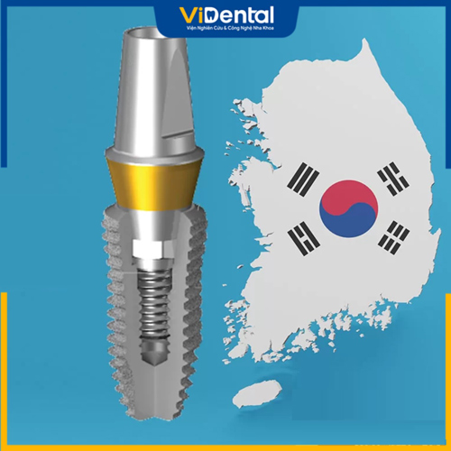 Trụ Implant Dentium Hàn Quốc được khách hàng Việt ưa chuộng