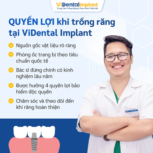 ViDental Implant mang đến dịch vụ trồng răng uy tín, chất lượng