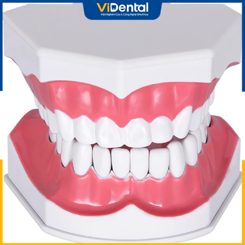 Bệnh nhân cần tái khám định kỳ để bác sĩ đánh giá tình trạng răng miệng