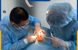 6 Điều Kiện Để Trồng Răng Implant Thành Công Tránh Biến Chứng