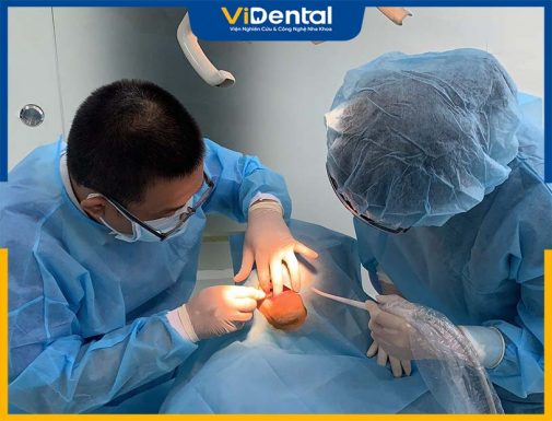 6 Điều Kiện Để Trồng Răng Implant Thành Công Tránh Biến Chứng