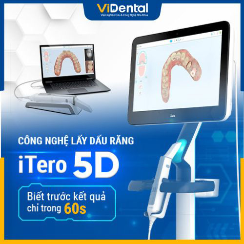 ViDental Implant sở hữu công nghệ nha khoa hiện đại