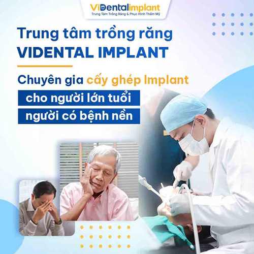 ViDental Implant chuyên cung cấp các dịch cụ trồng răng, cấy Implant