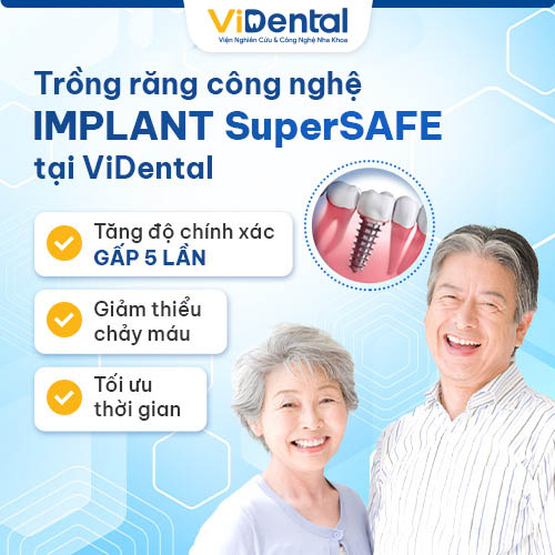 ViDental Implant là địa chỉ trồng răng Implant hàng đầu hiện nay