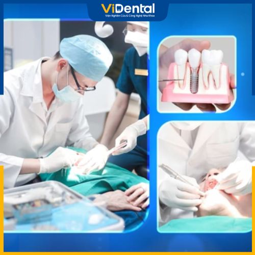 Cần tháo trụ Implant, khắc phục biến chứng, hãy đến ngay ViDental Implant 