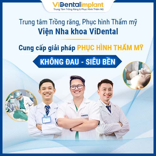 ViDental - Địa chỉ trồng răng Implant hàm trên uy tín, giá tốt nhất