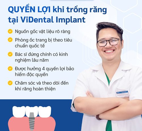 Khách hàng của ViDental Implant được hưởng nhiều quyền lợi