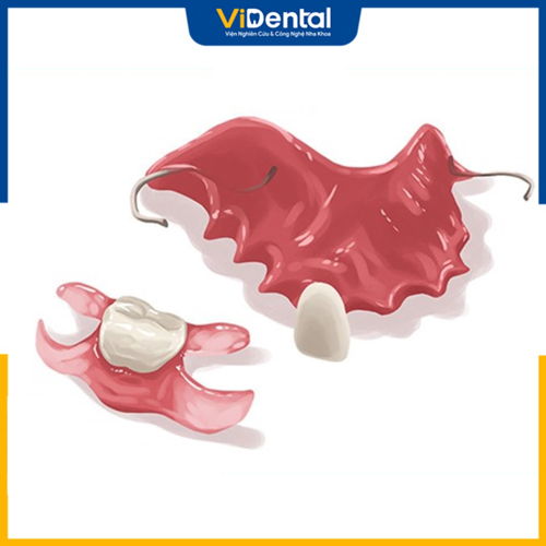 Quy trình chế tác và gắn răng giả tháo lắp cần đảm bảo khử trùng